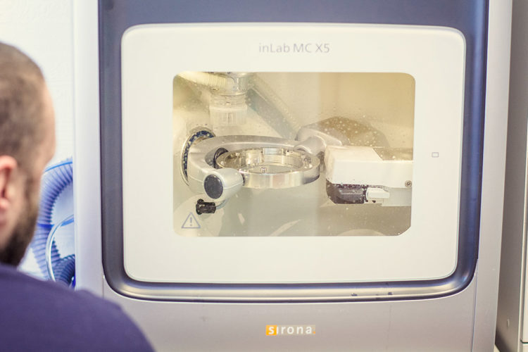 cerec система