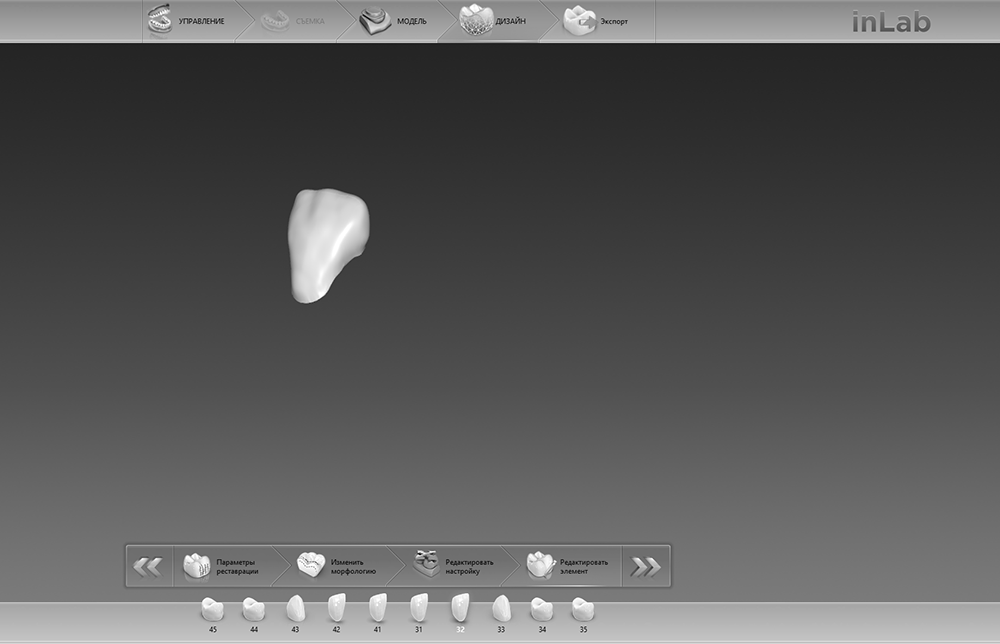 Изготовление виниров