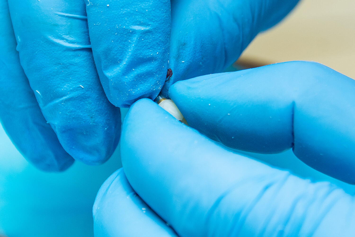 зубні коронки