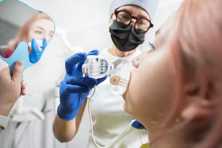 отбеливание зубов