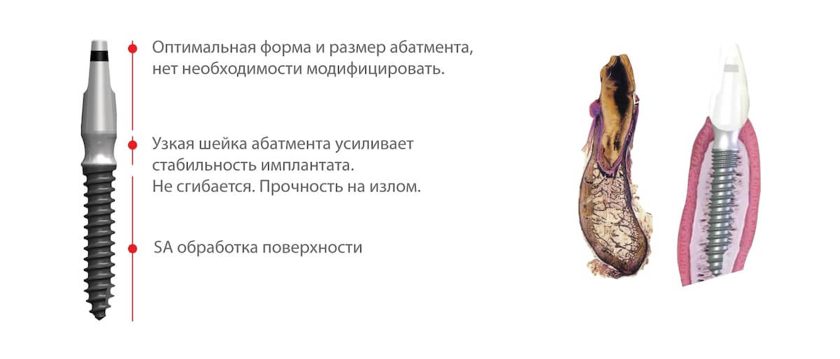 Osstem импланты