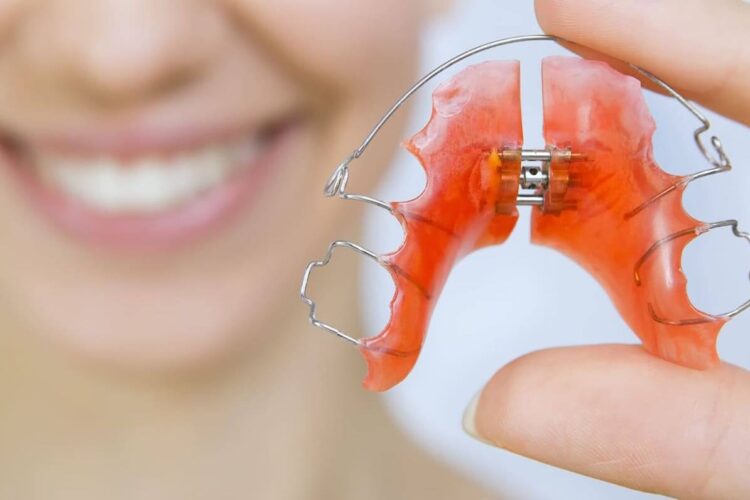 Ортодонтические пластинки