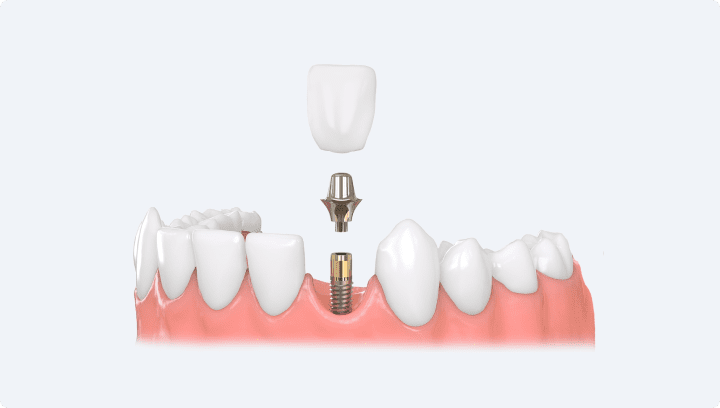 Одноэтапно