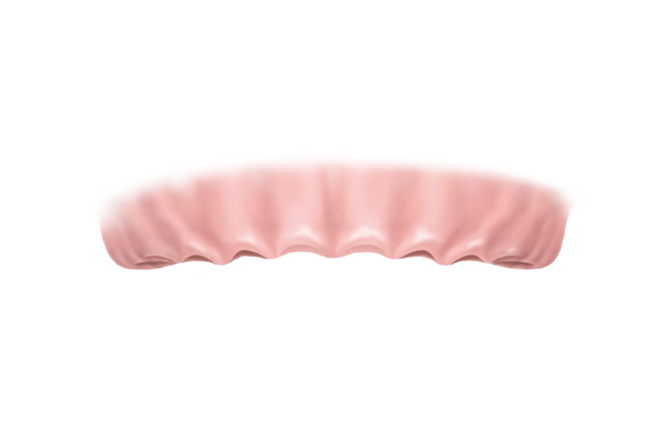 Имплантация All-on-4