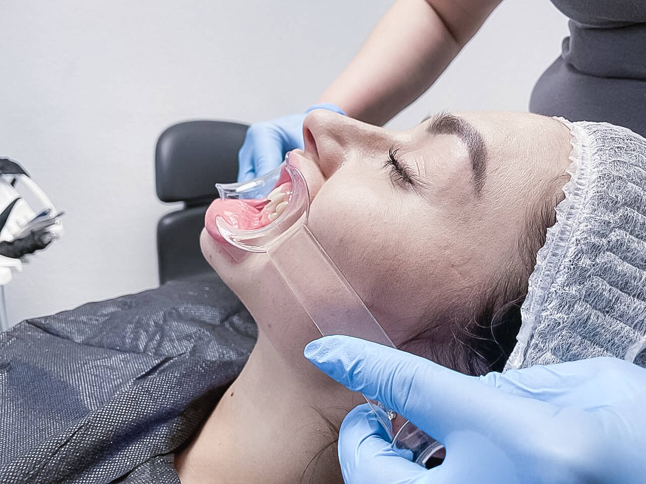 Протезування зубів на імплантах