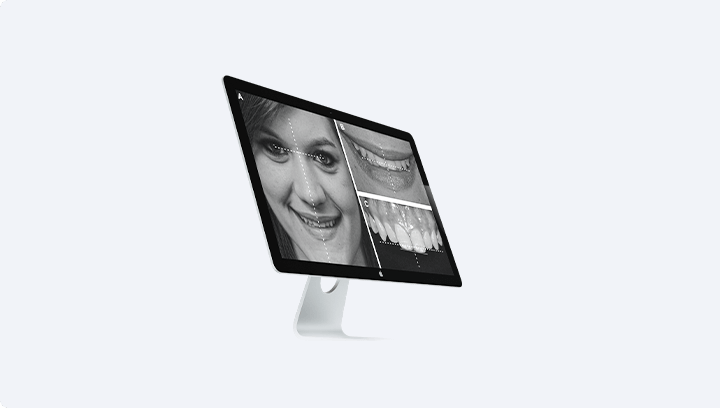 Виготовлення моделі майбутніх зубів