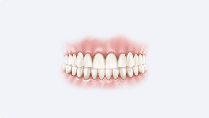 Виготовлення моделі майбутніх зубів