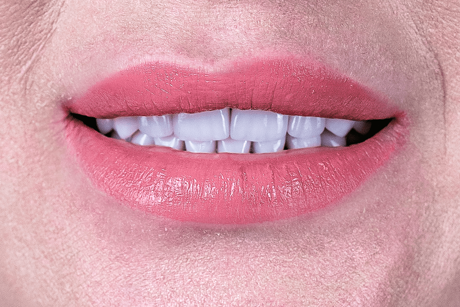 Імплантація й протезування коронками