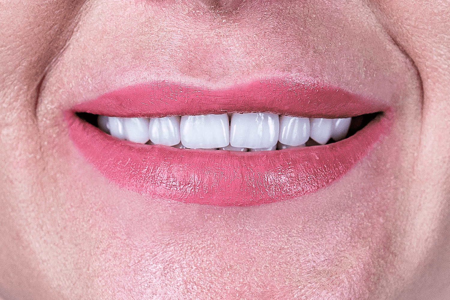 Імплантація й протезування коронками