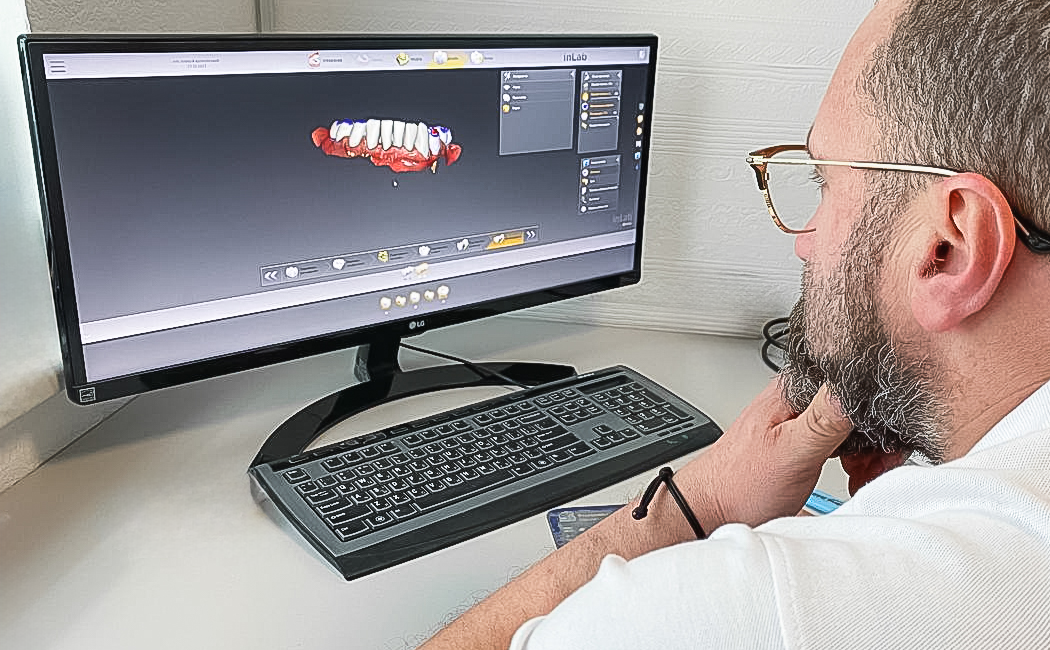 Імплантація та протезування коронками e.max