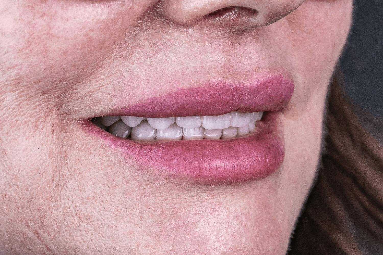 Імплантація й тотальне протезування зубів