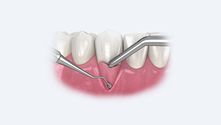 Рецесія ясен: опустилися ясна, що робити?