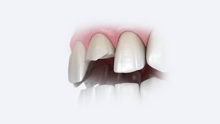 Зубний біль і його причини