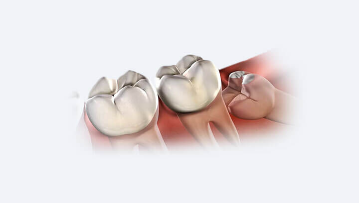 Зубний біль і його причини