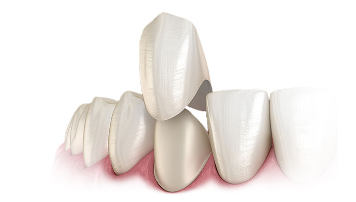 Дитячі зубні коронки