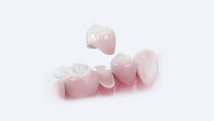 Дитячі зубні коронки