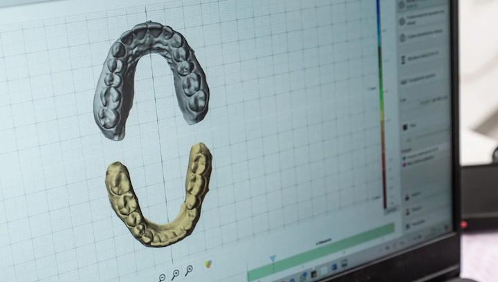 Гнатологія