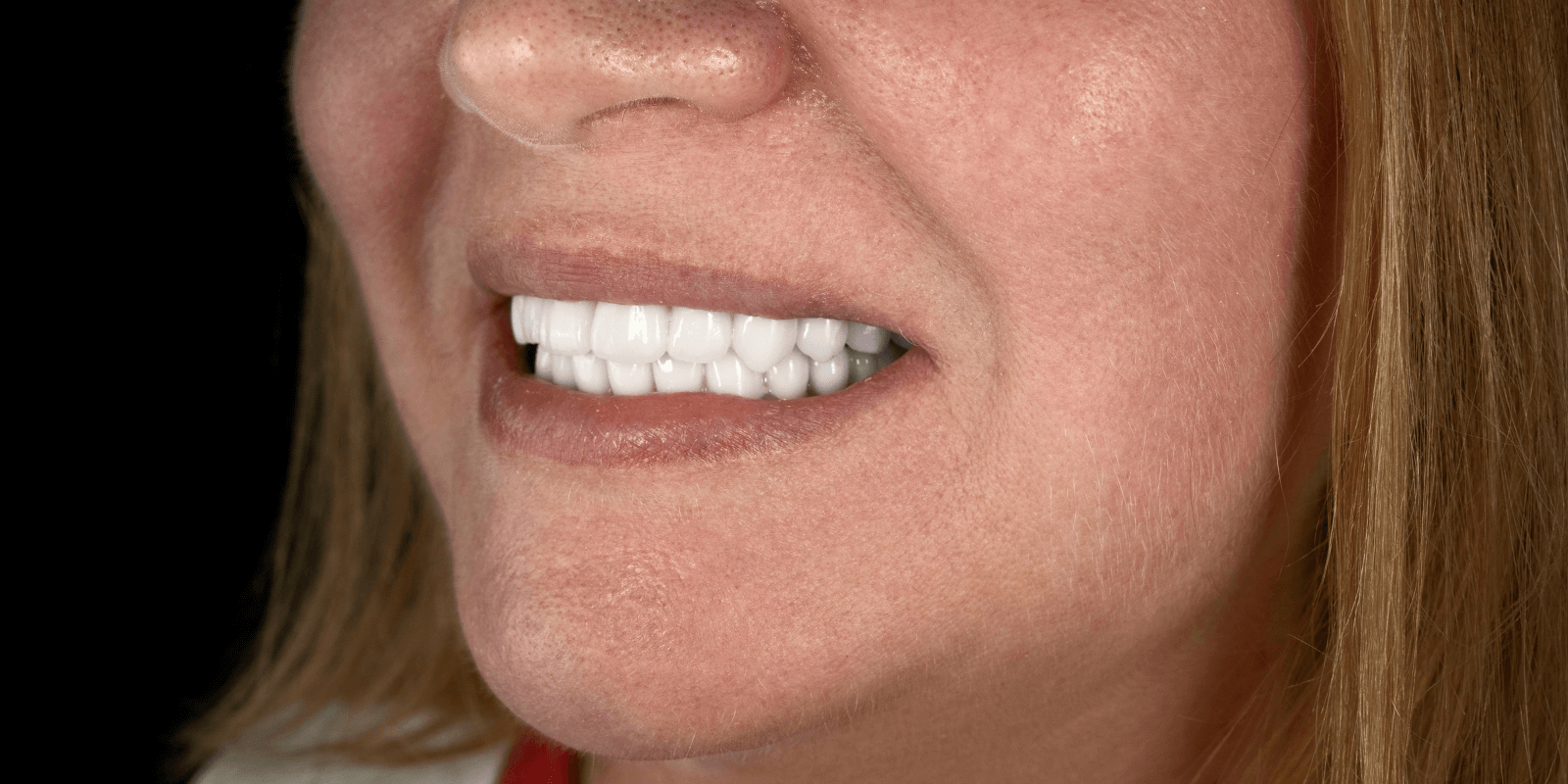 Імплантація та протезування коронками з діоксиду цирконію