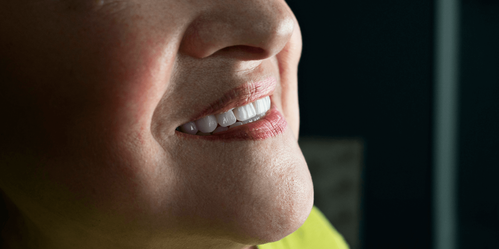 Замінили старі мости на імпланти та коронки з діоксиду цирконію