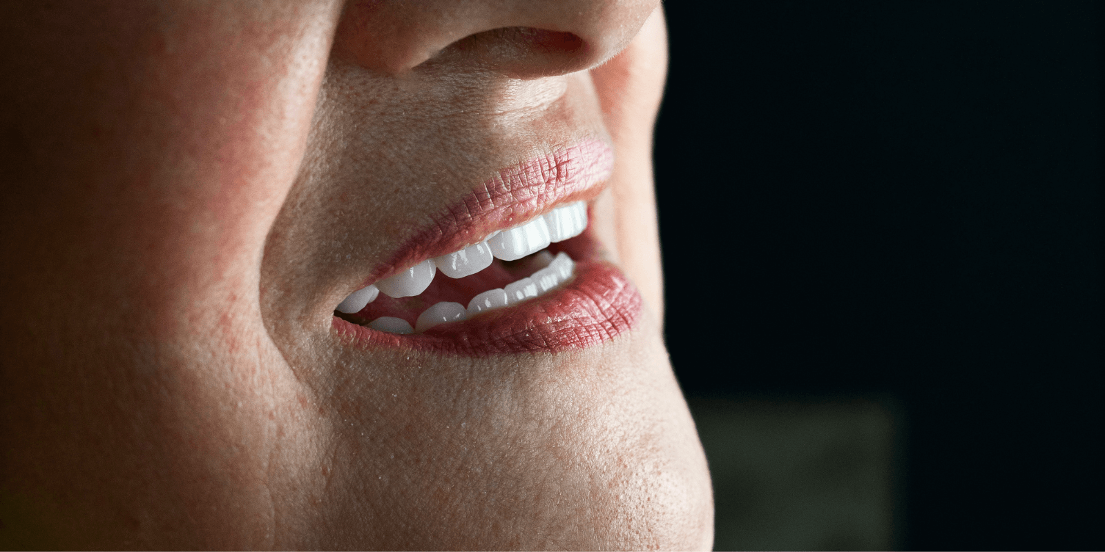 Замінили старі мости на імпланти та коронки з діоксиду цирконію