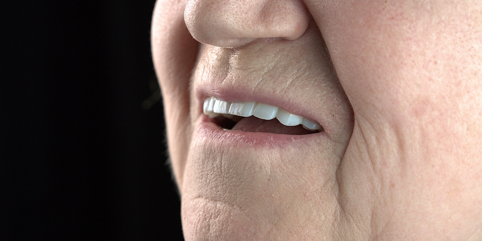 Від знімних протезів до імплантів Straumann в 73 роки