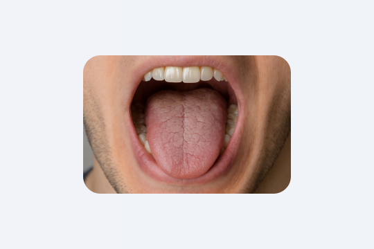 Зуби руйнуються без болю: правда, яку ігнорують