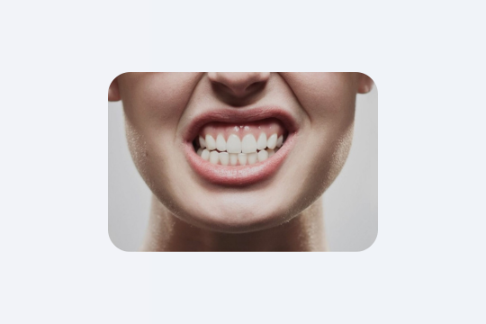 Зуби руйнуються без болю: правда, яку ігнорують