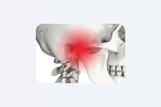 М’юїнг: що це таке і чи дійсно працює?