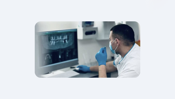 Імплант може прослужити понад 20 років: 5 ключових умов