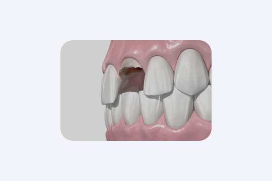 М’юїнг: що це таке і чи дійсно працює?