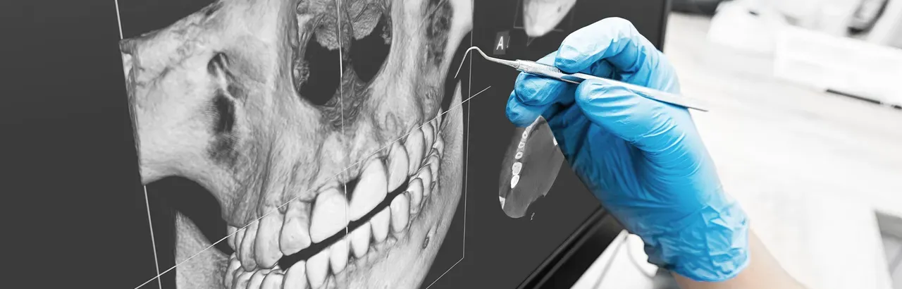 Періодонтит: причини, симптоми та ускладнення