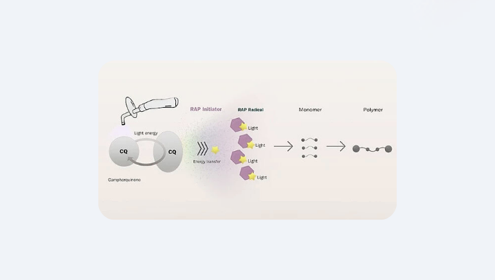 Чому вартість пломби буває різною: навіть в одній клініці