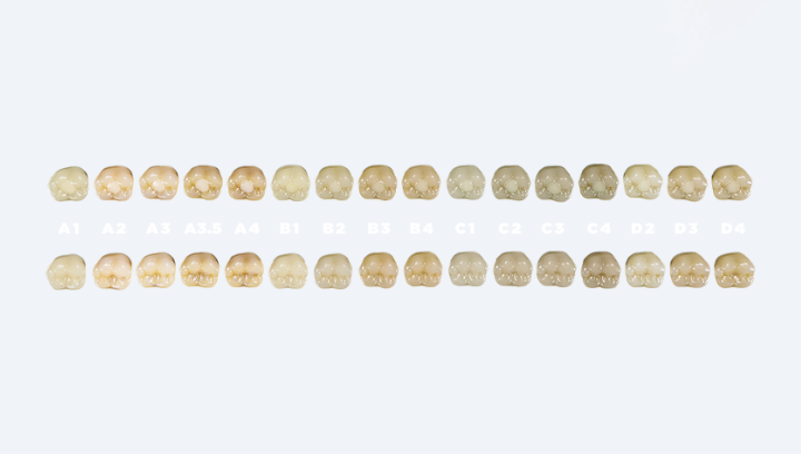 Чому вартість пломби буває різною: навіть в одній клініці