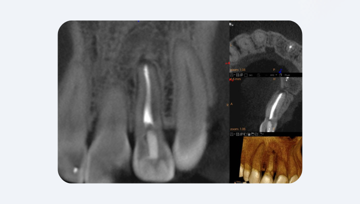 Навіщо КТ, якщо є звичайний рентген?
