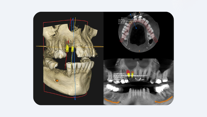 Навіщо КТ, якщо є звичайний рентген?