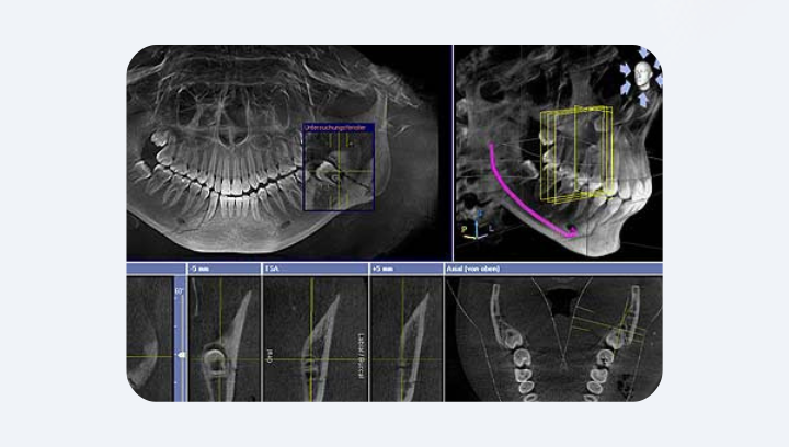 Навіщо КТ, якщо є звичайний рентген?