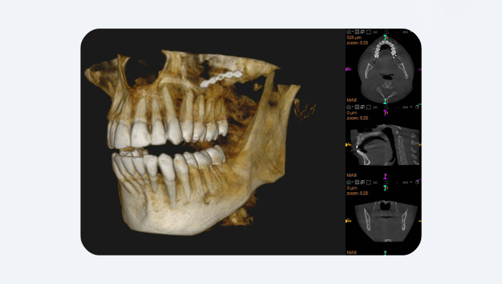 Навіщо КТ, якщо є звичайний рентген?