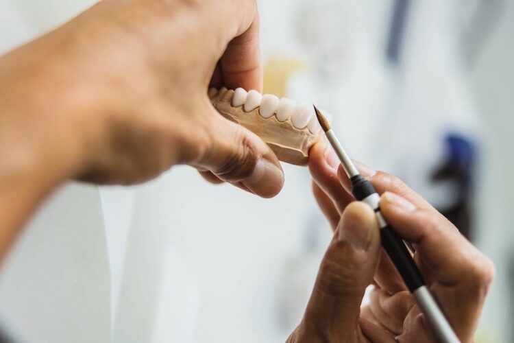 Вініри на зуби: як створюють голлівудську усмішку