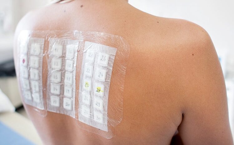 Чи безпечні метали в роті: коронки, імпланти, алергія