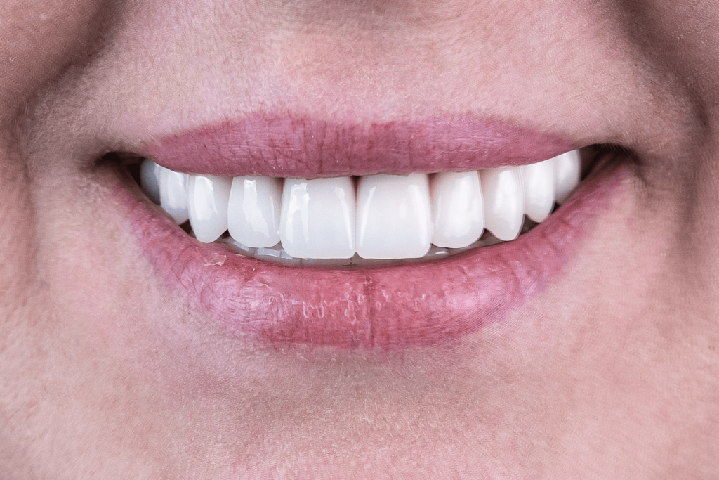 Имплантация и протезирование при пародонтите