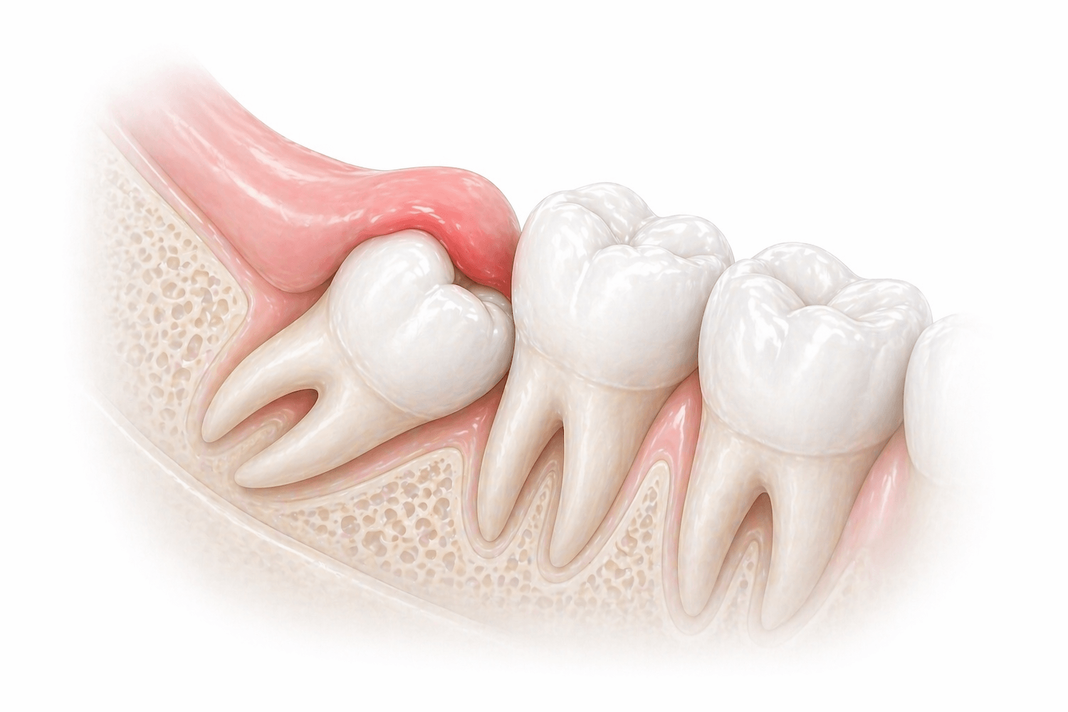 Набрякла щока (флюс): причини та що робити
